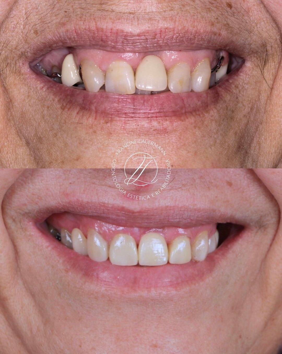 Francine Lauermann-0