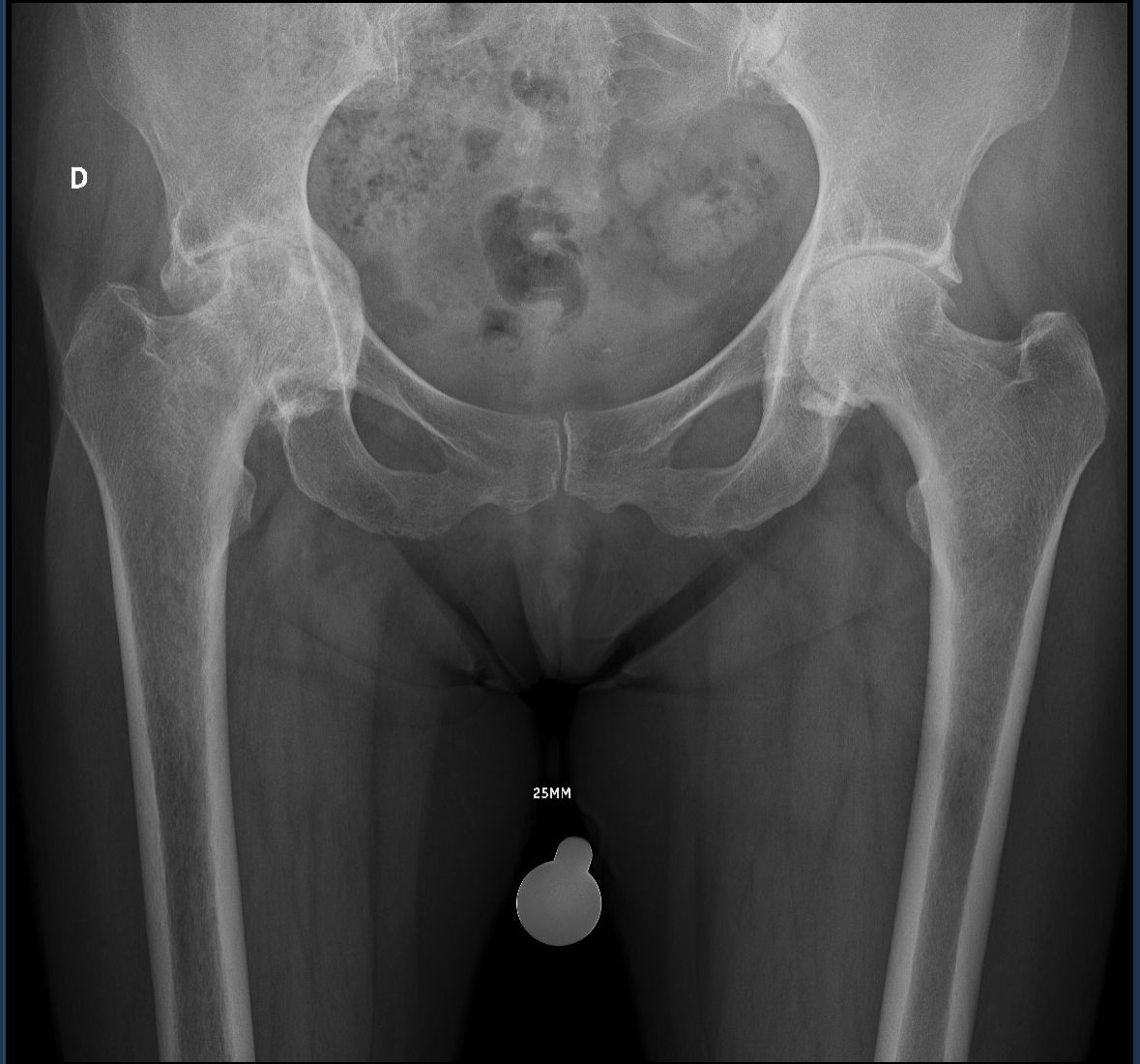 Saul Gerardo Gutierrez Rojas-11