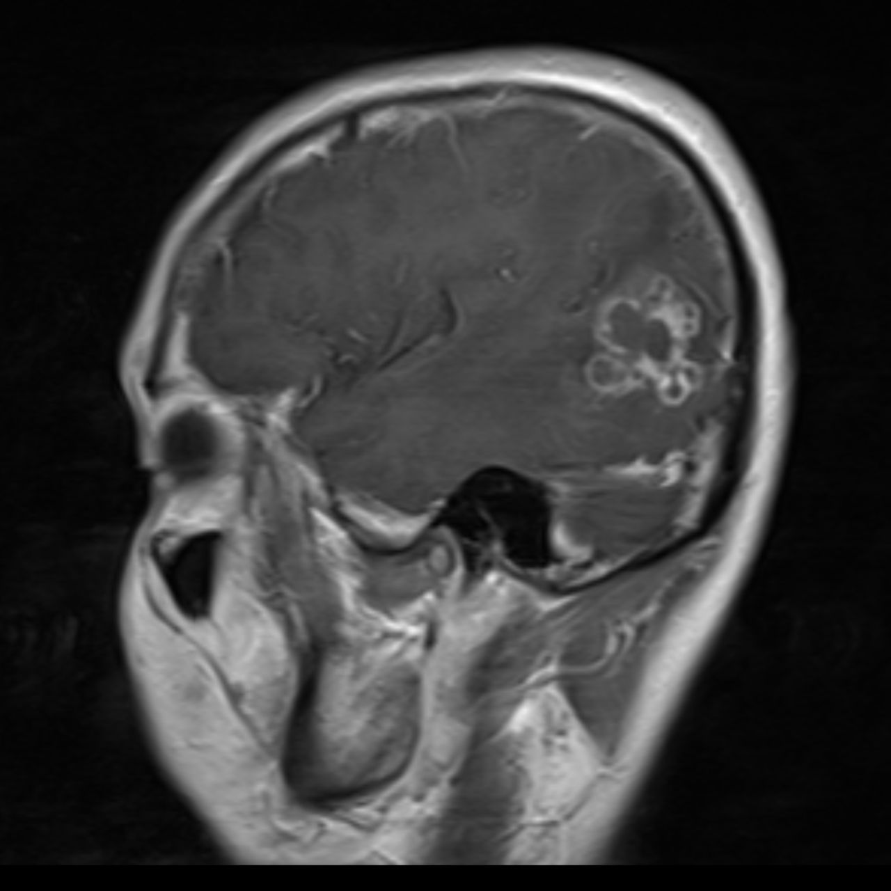 David Tafur Muñoz-1954