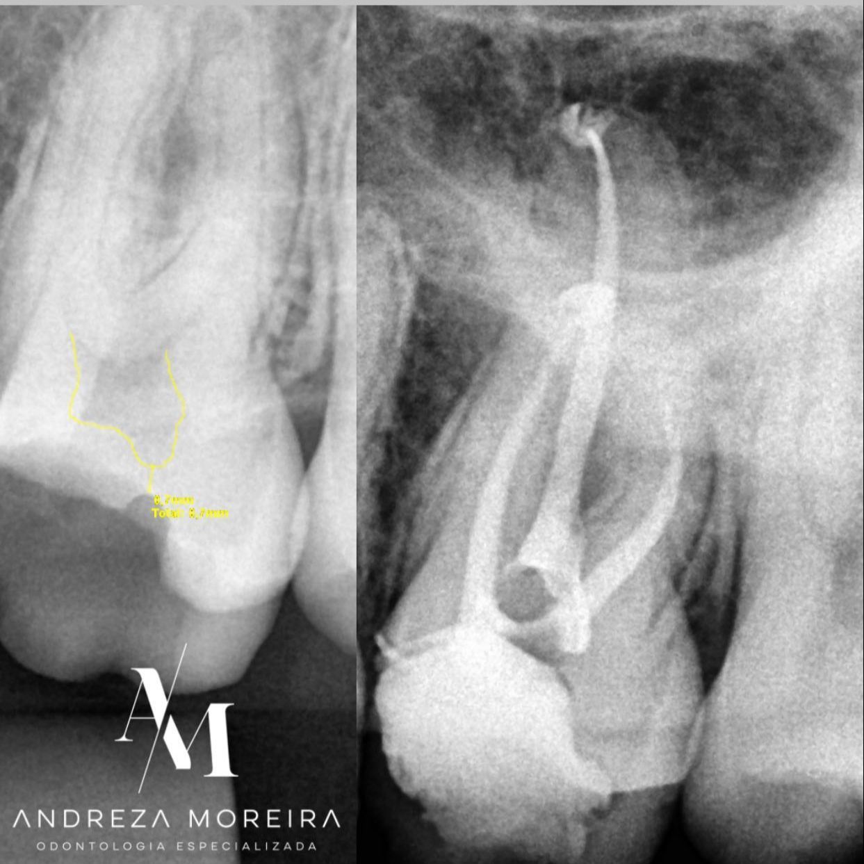 Andreza Moreira-6