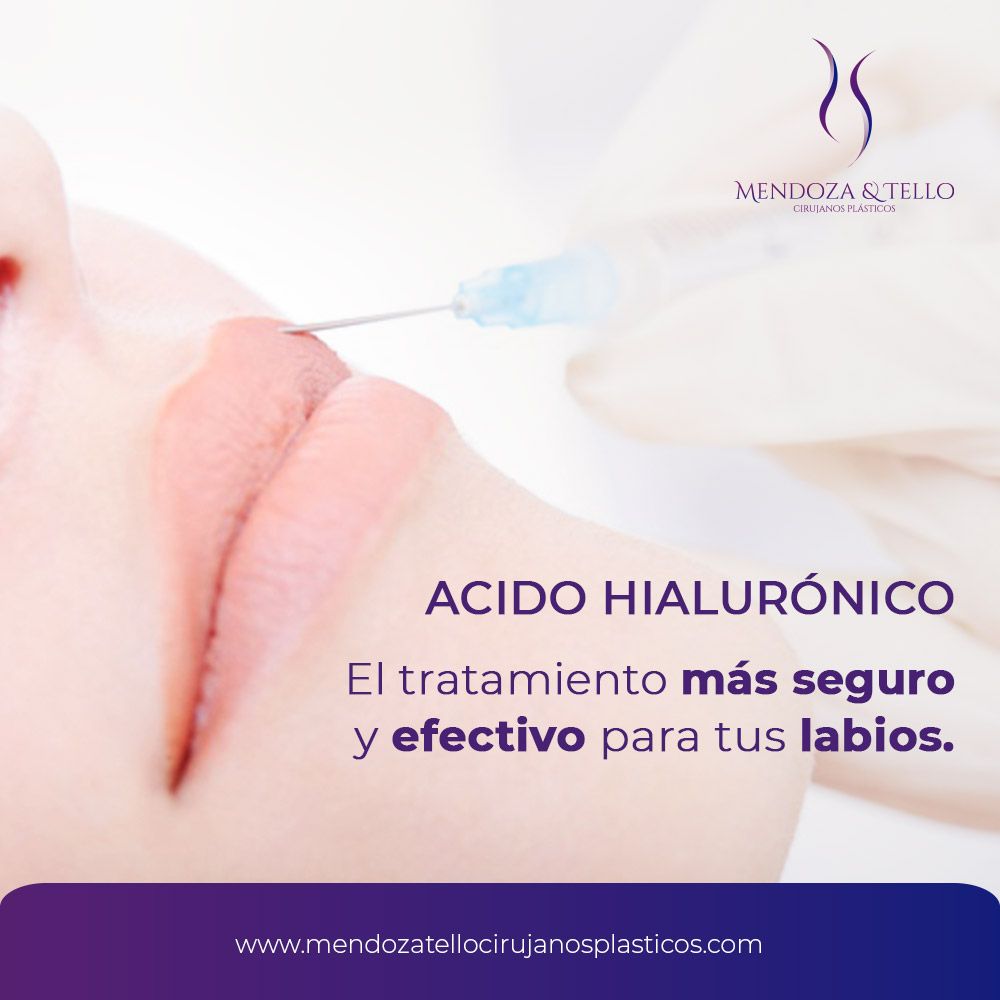 Liliana Tello Quijano-54