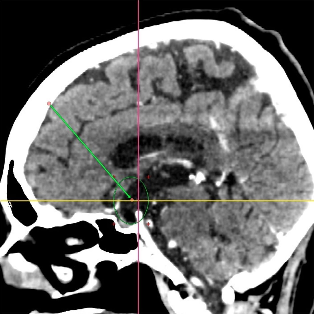 David Tafur Muñoz-1394