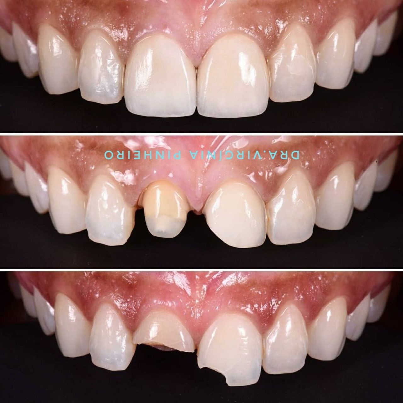 Ana Virginia  Pinheiro -1