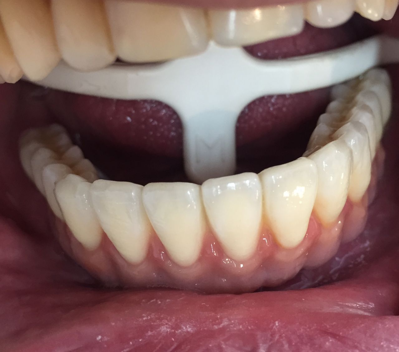 Isail Klahr Averbuch-4