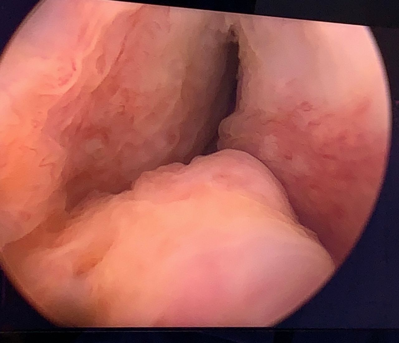 Juan Guillermo Velásquez López-14