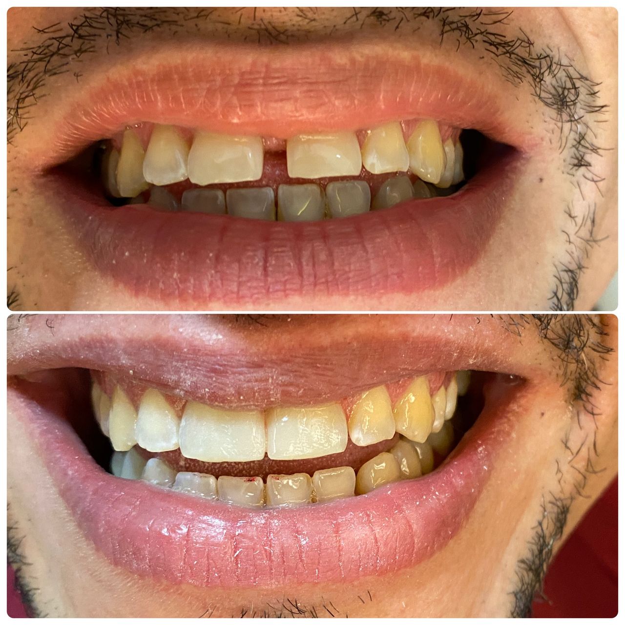 Leandro Ponte Dias-21