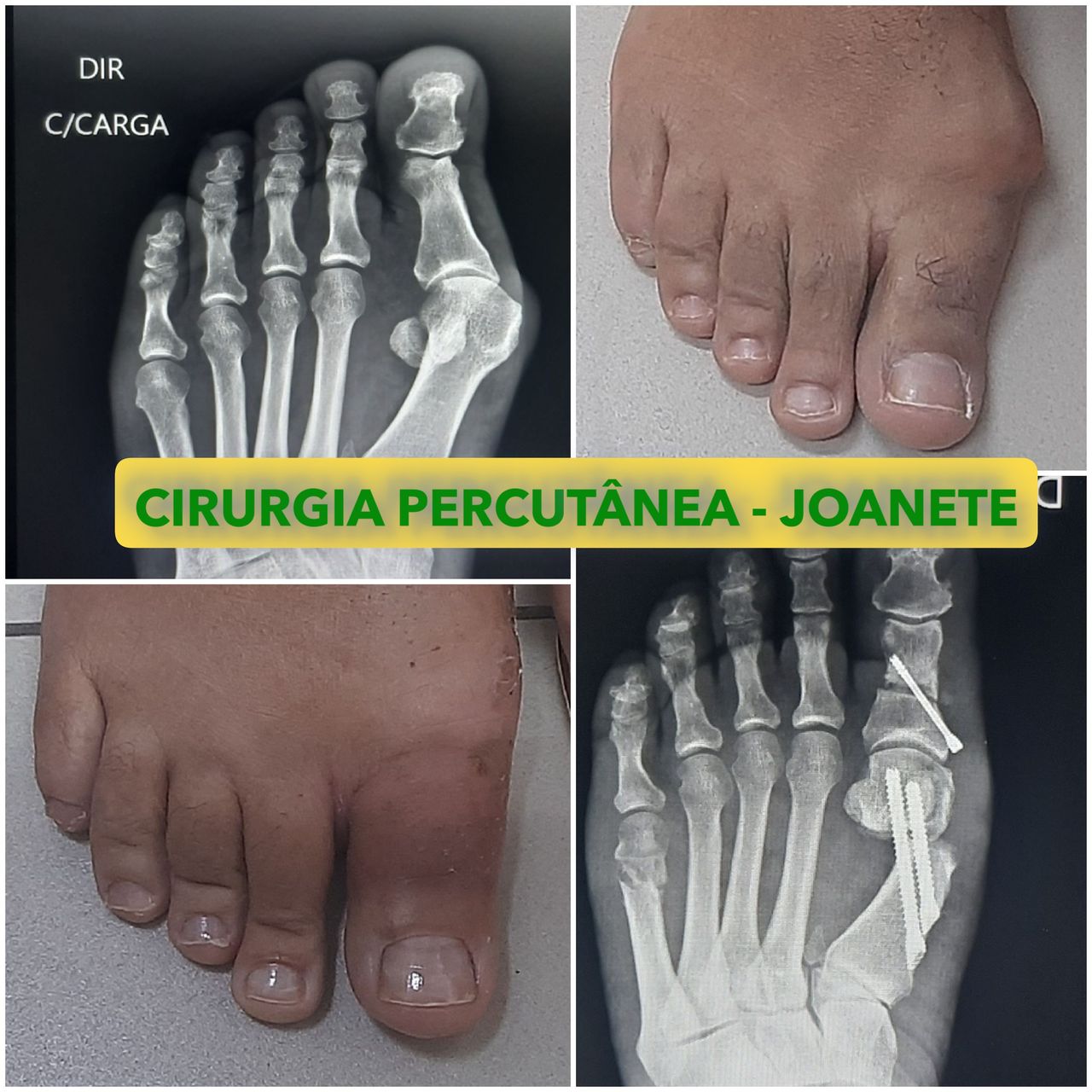 Gustavo Heringer Silveira-5