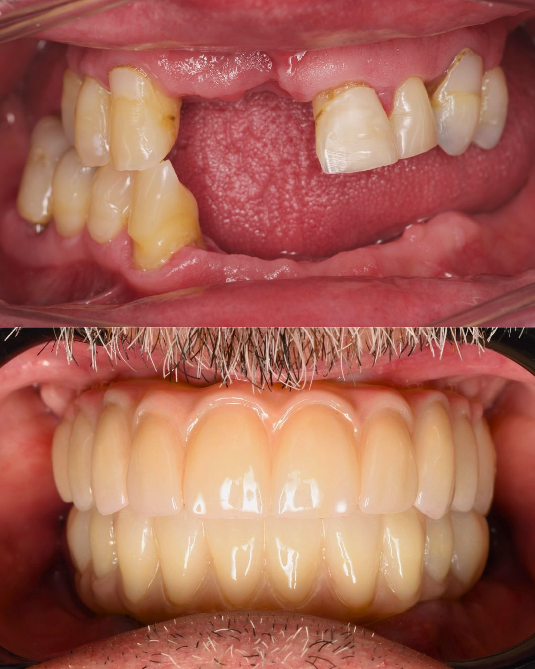 Andrés Verdugo Bolumburu-3