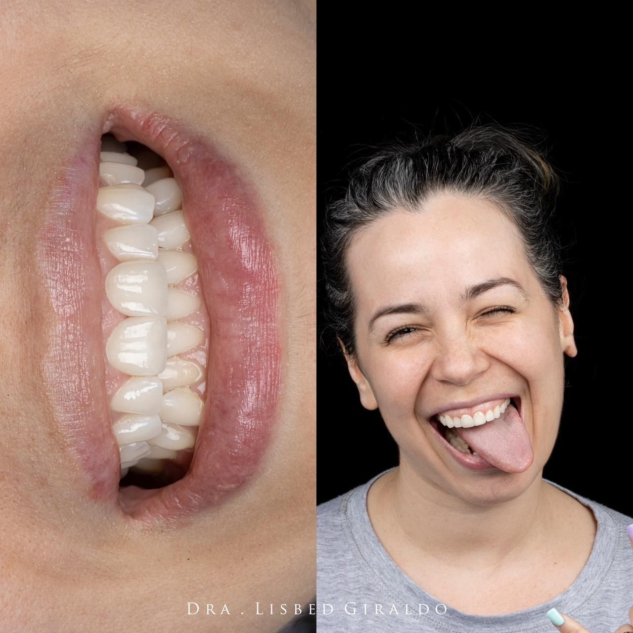 Lisbed Giraldo Olarte-33