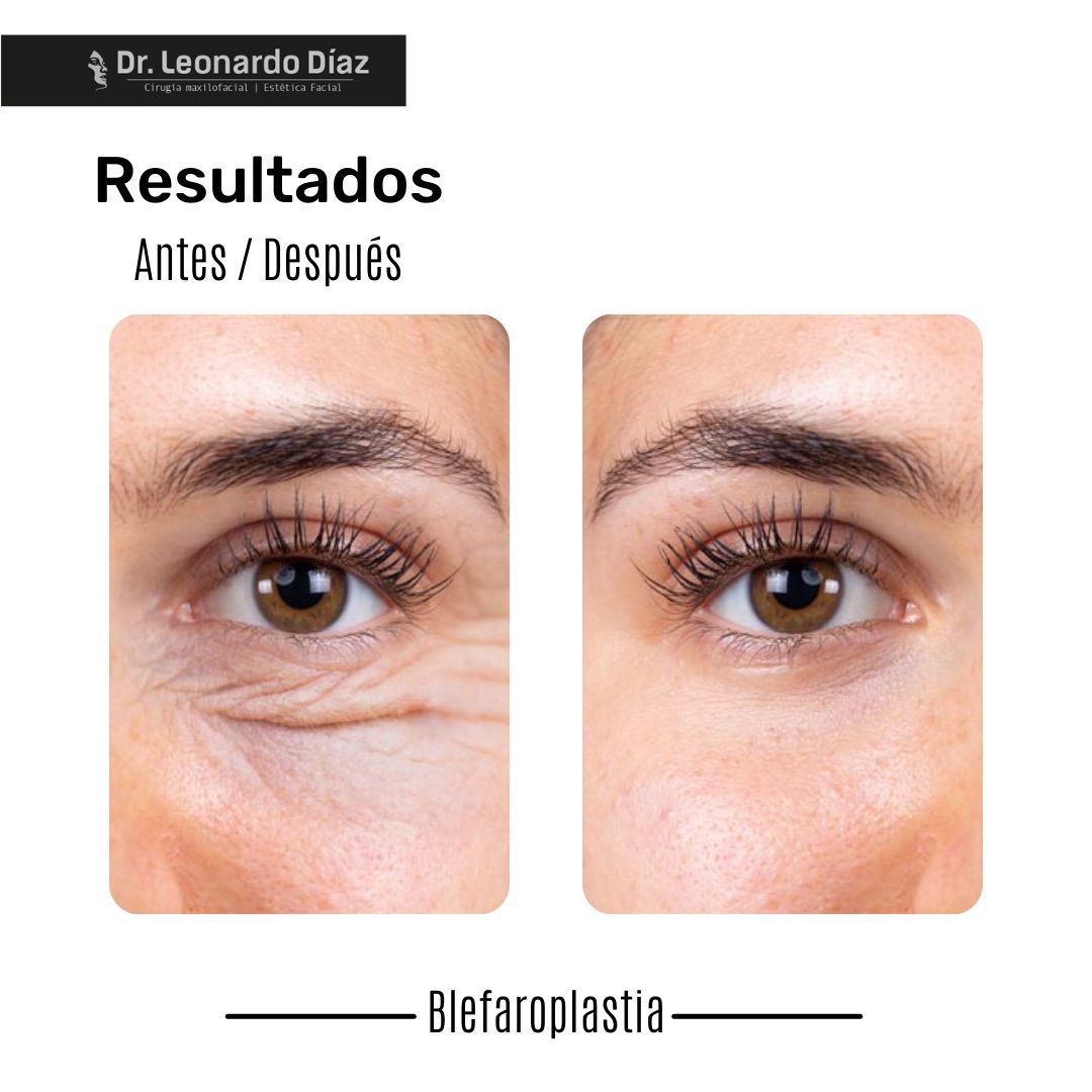 Leonardo Diaz Martínez-14