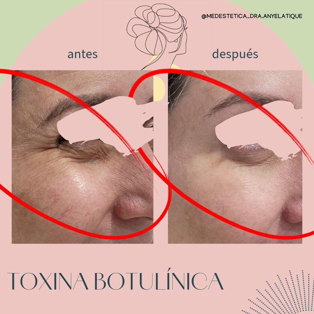 Anyela Tique Hilarión-7