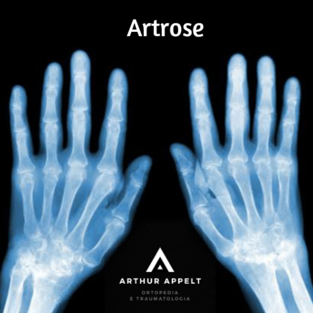 Arthur Lanna Appelt-3