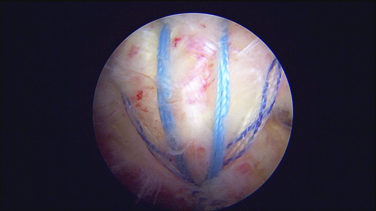 Jairo Hernan Villa Bandera-3