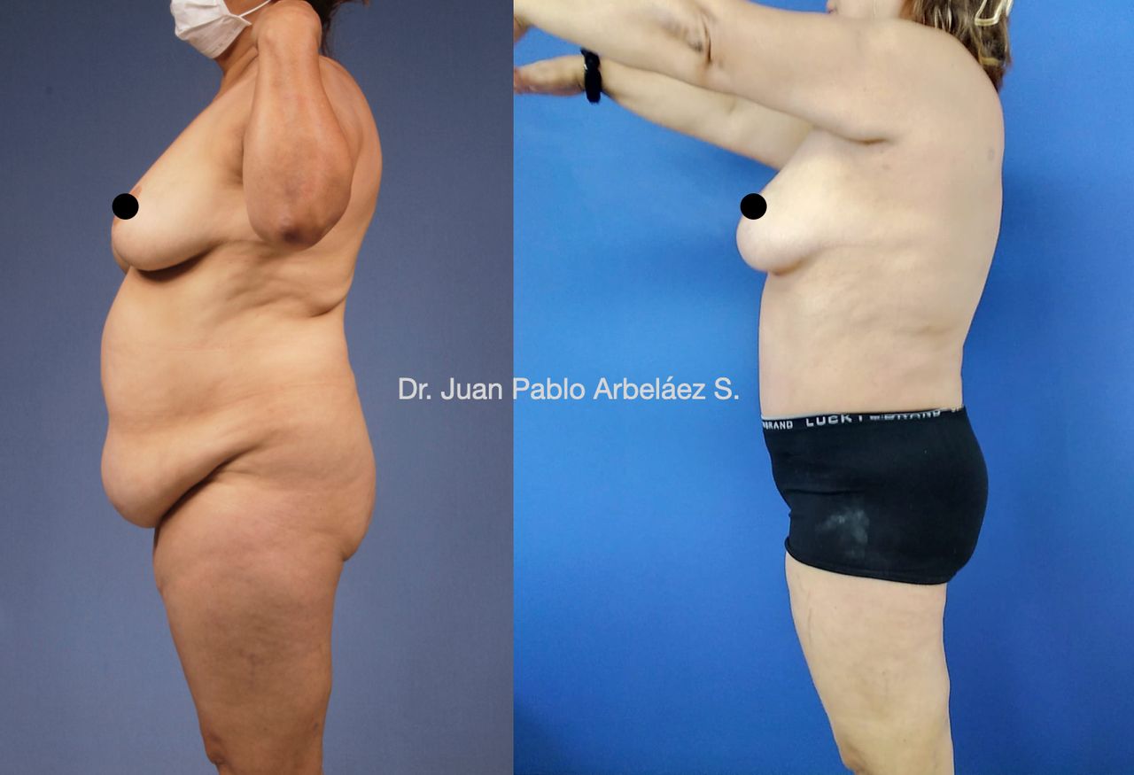 Juan Pablo Arbeláez Sierra-41