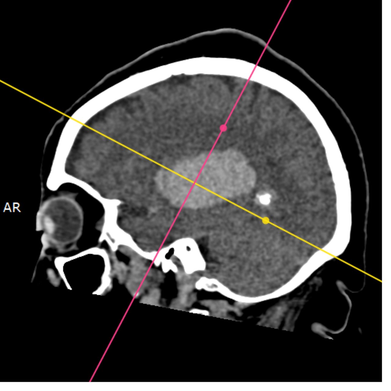 David Tafur Muñoz-1957