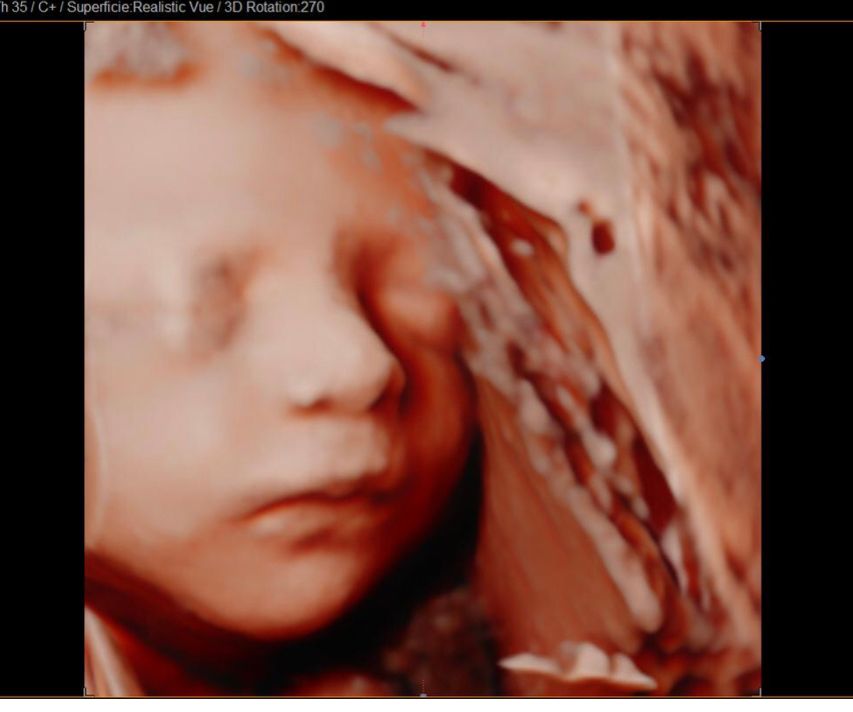 Jonh Harold Alvis Botello-13