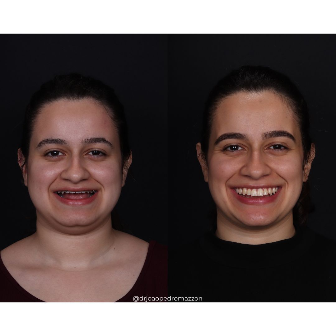 João Pedro Paulino Mazzon-62