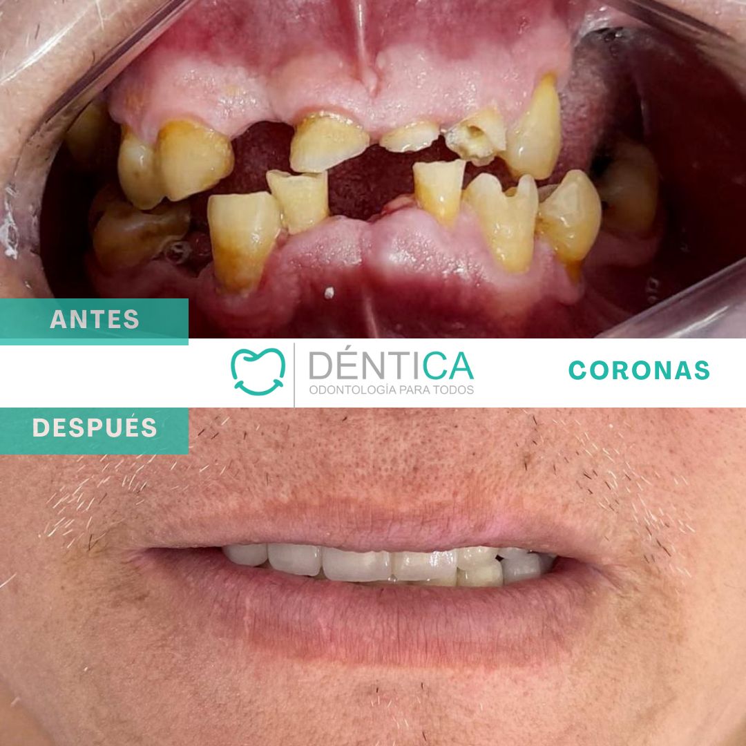 Estefani Canches Caballero-9