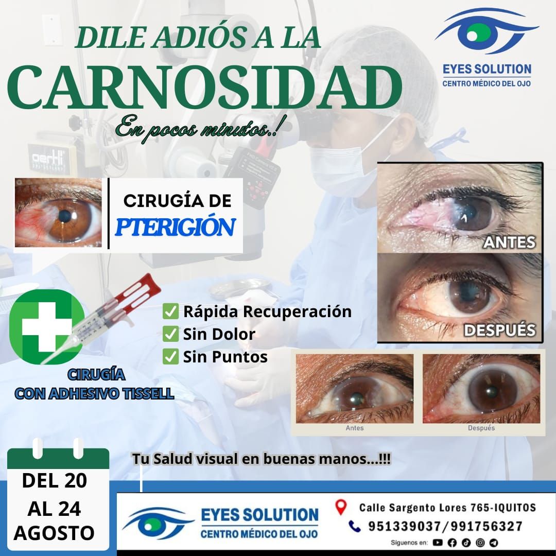 Miguel Ángel Pinedo Saboya-32