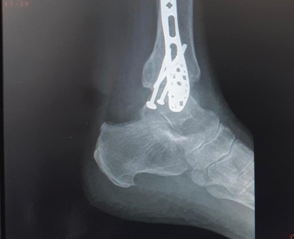 Luz Angela Murcia Camargo-47