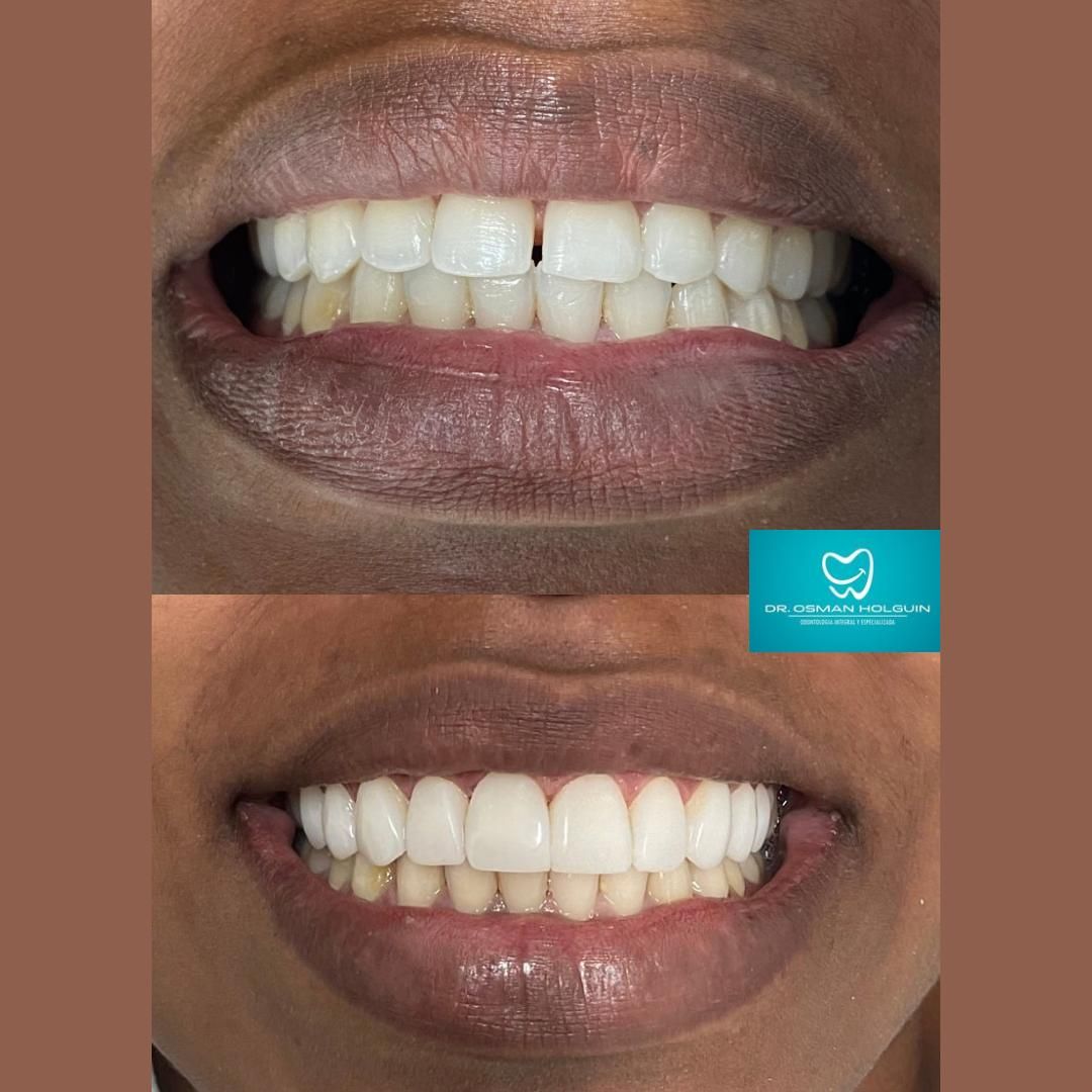 Osman Fernando Holguin Grisales-4