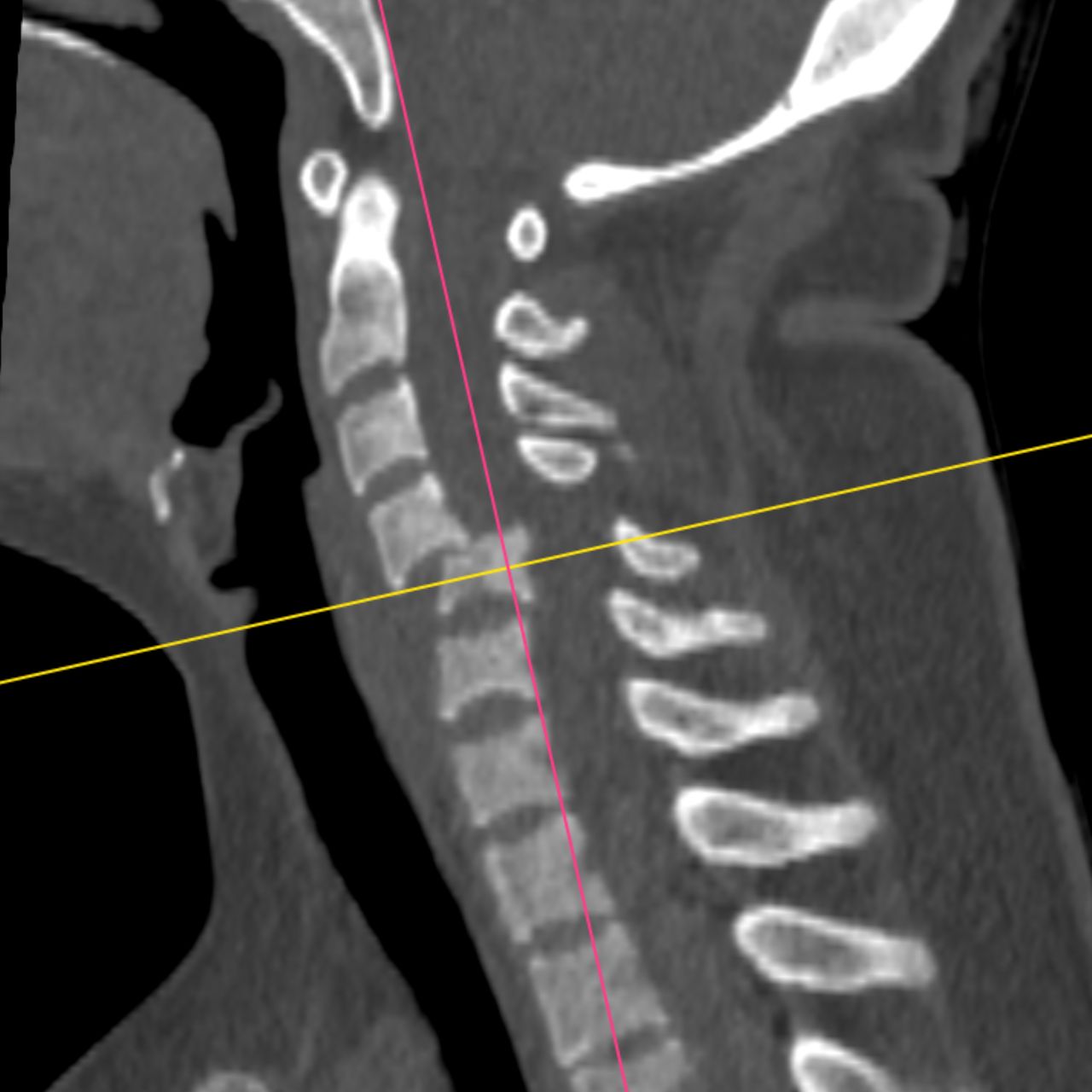 David Tafur Muñoz-1852