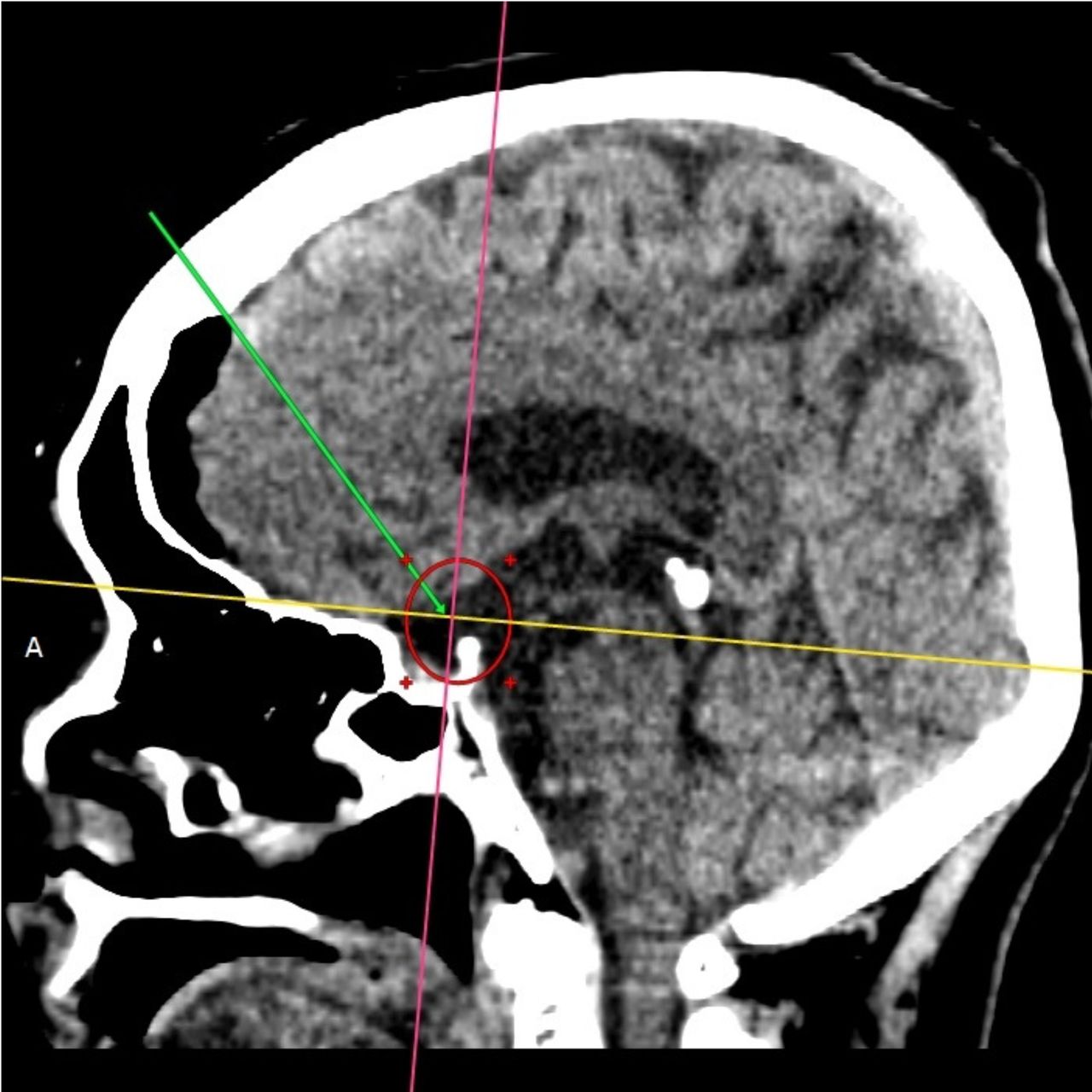 David Tafur Muñoz-1376