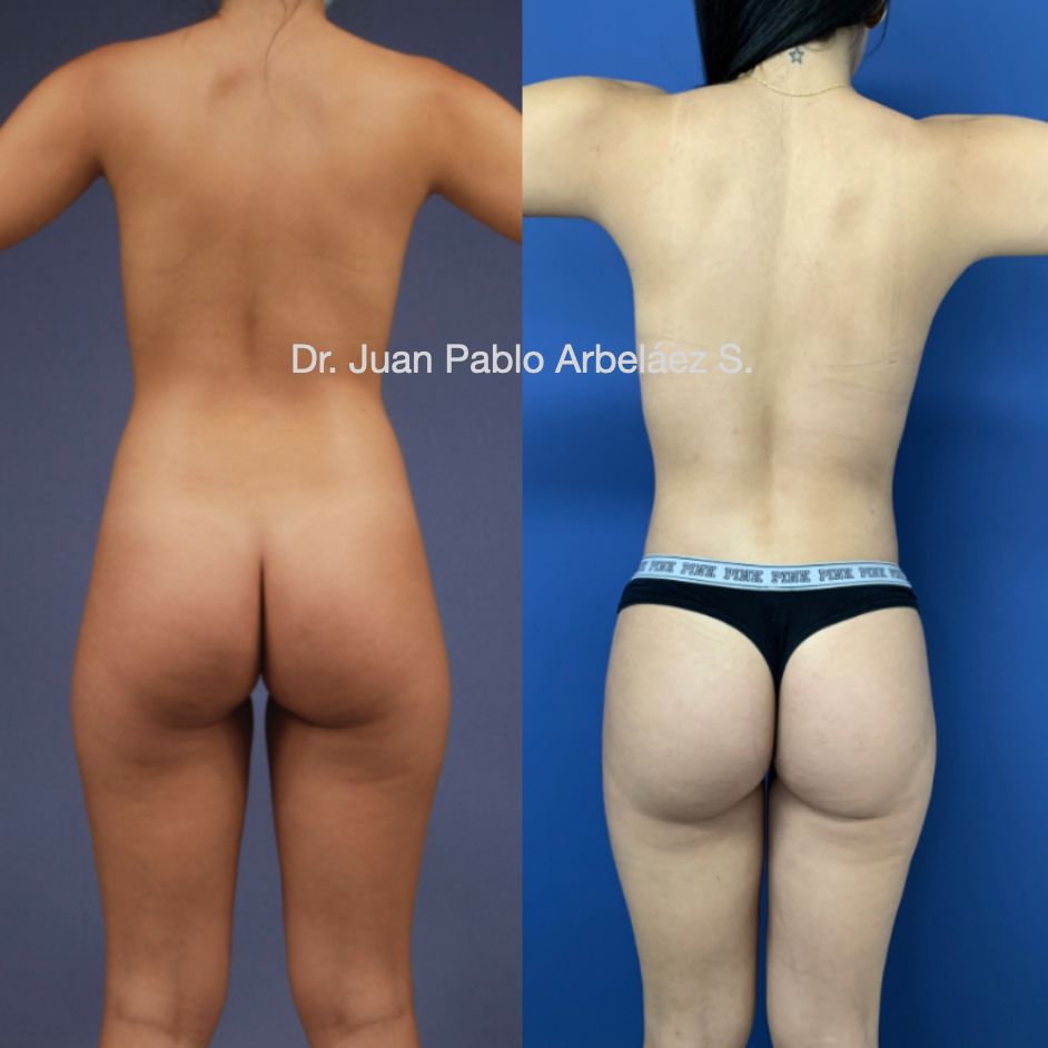 Juan Pablo Arbeláez Sierra-30