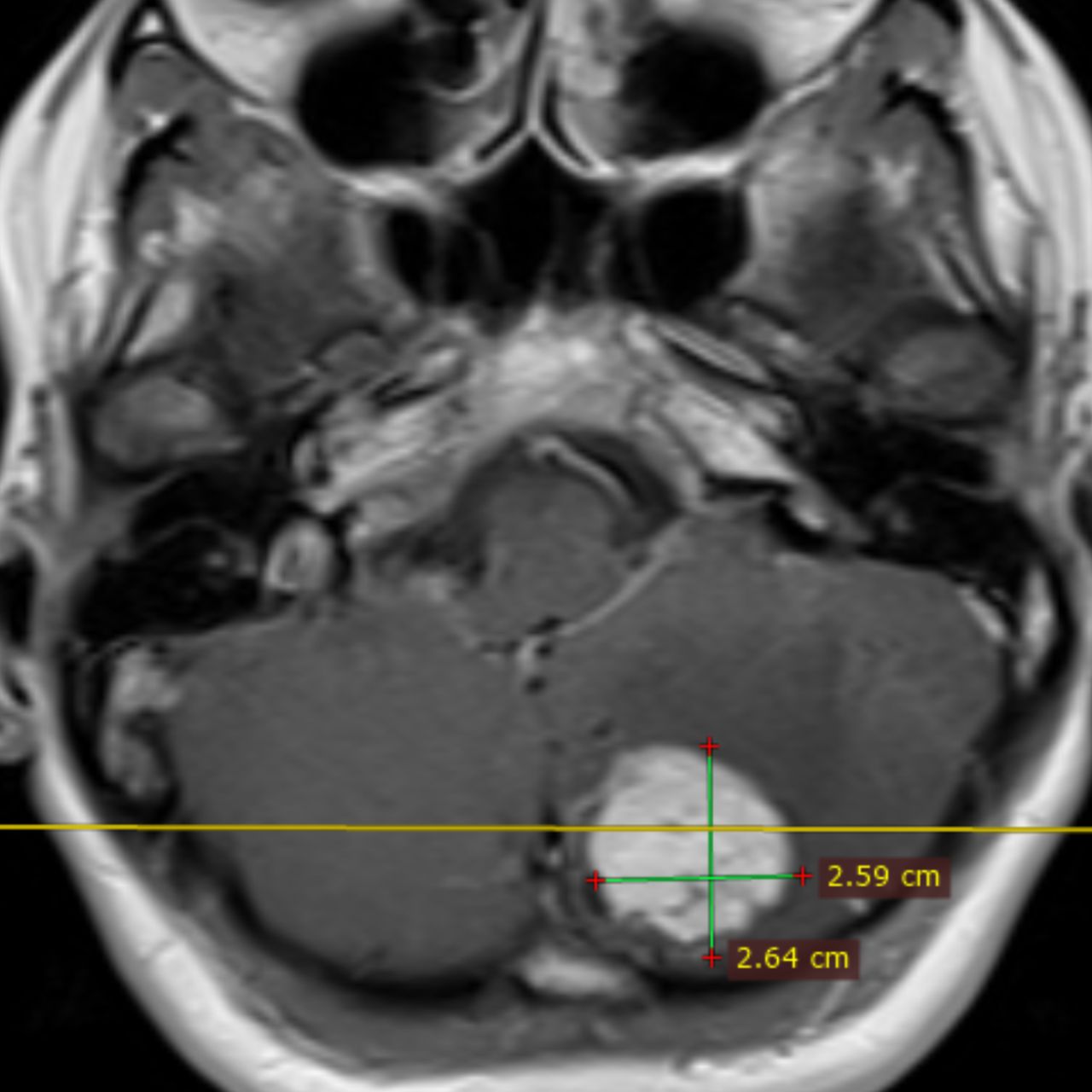 David Tafur Muñoz-1661