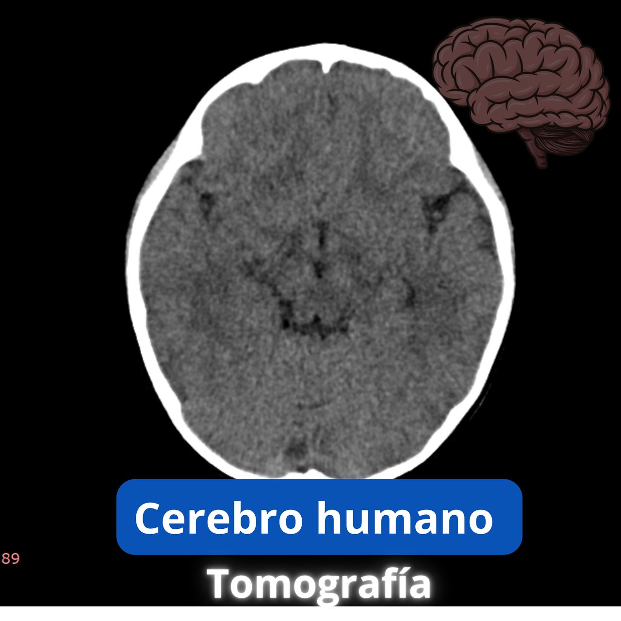 David Tafur Muñoz-1411