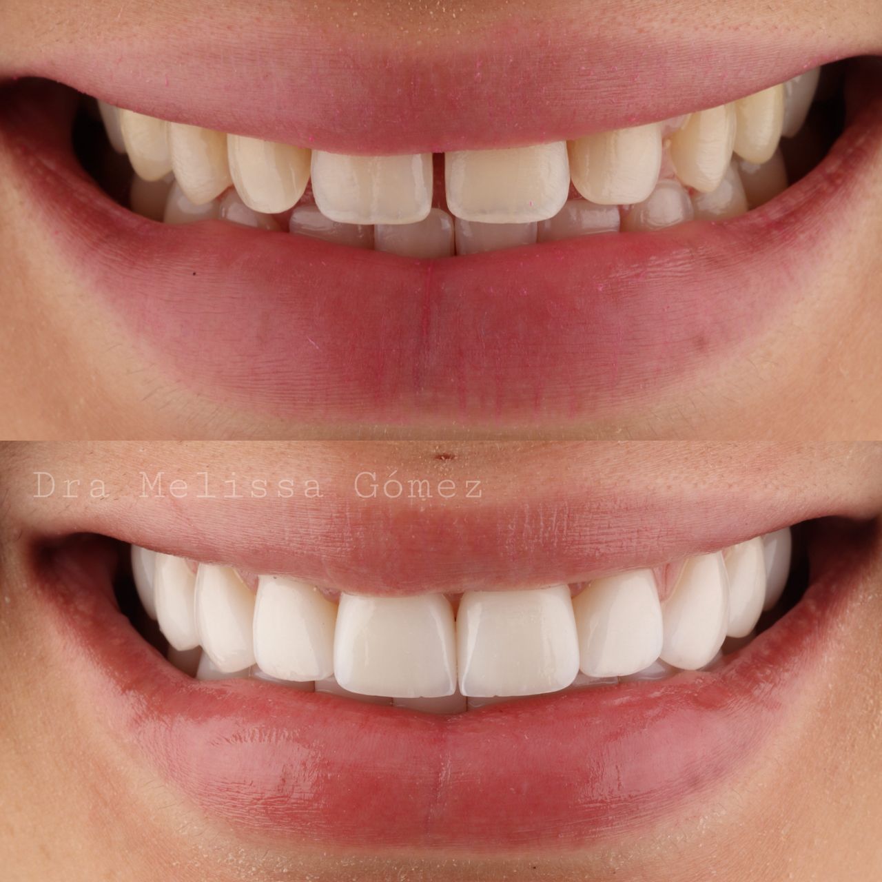 Melissa Gómez Arango-23