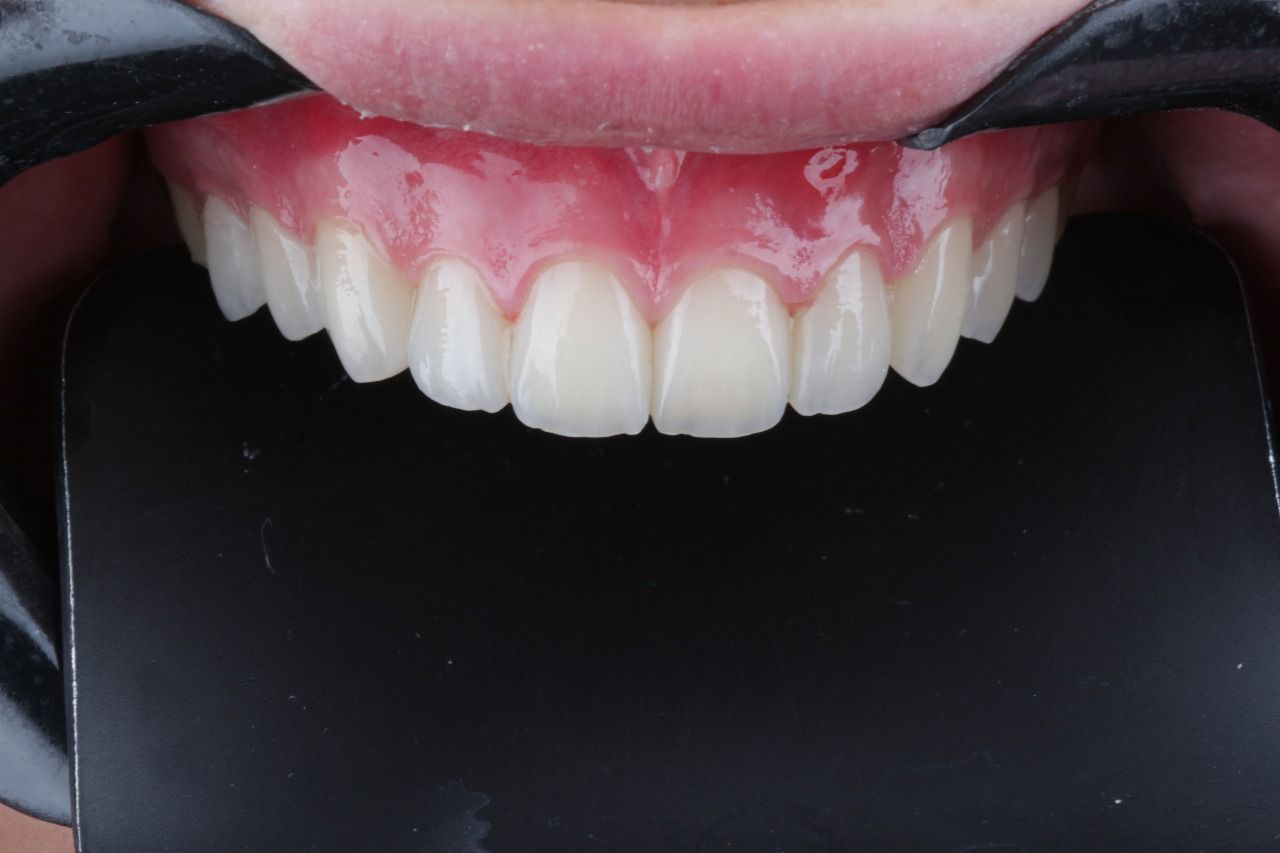 Guilherme  Carvalho-5