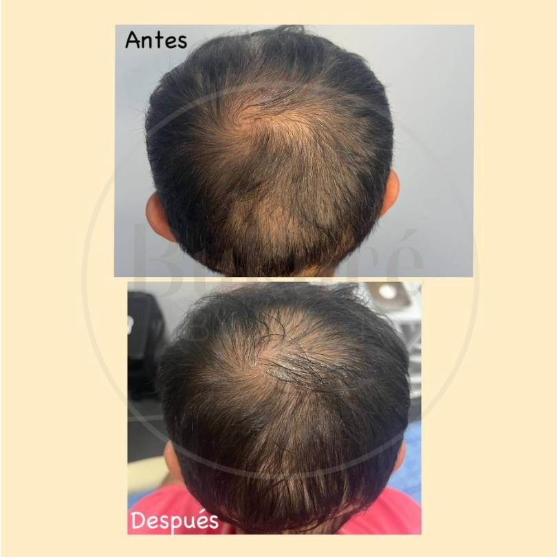 Oscar Iván Lozano Navarrete-17