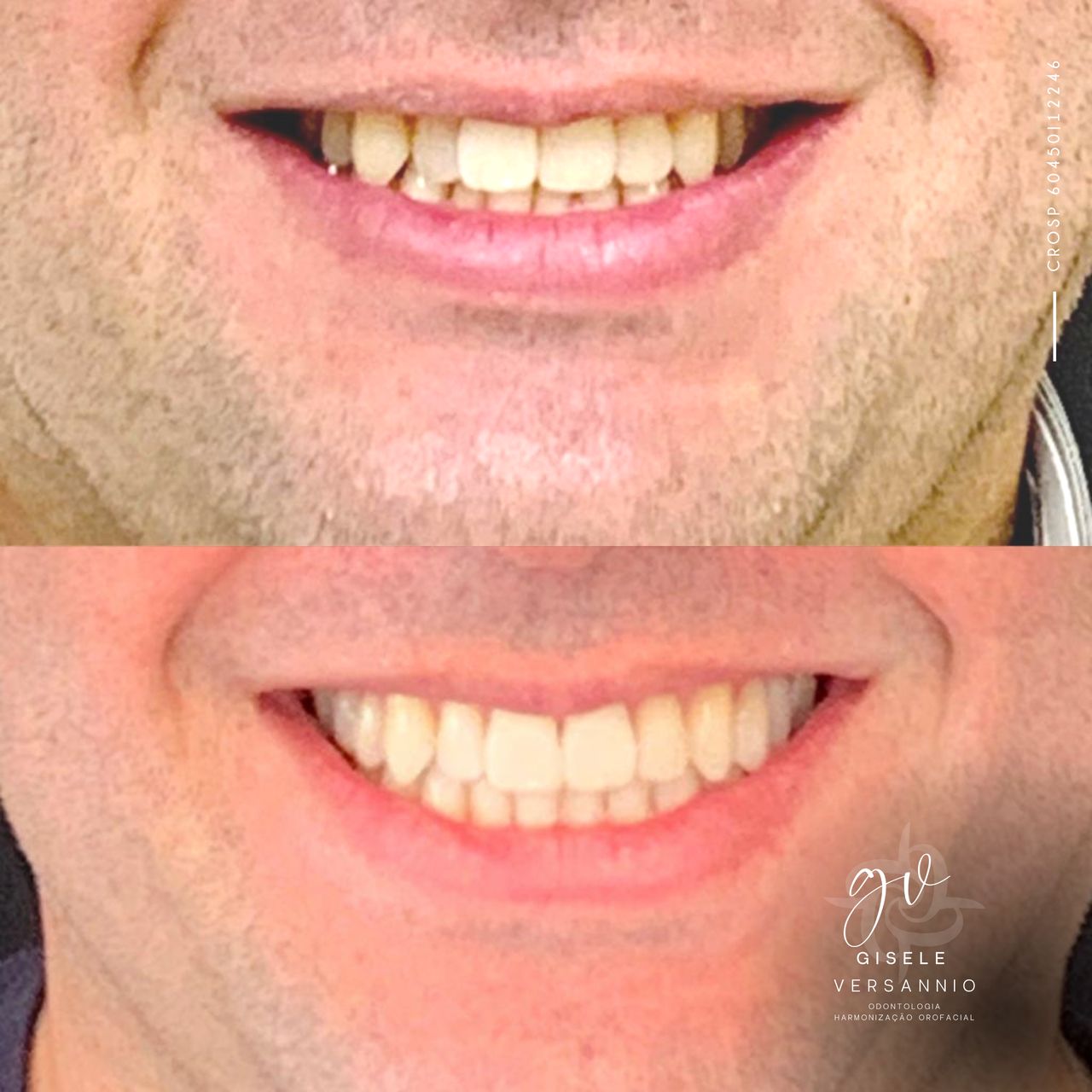 Gisele De Carvalho Versannio-14