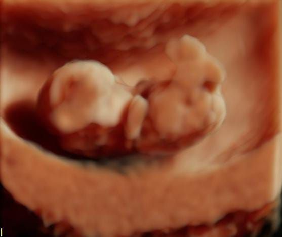 Lady Tatiana Duarte Lopez-7