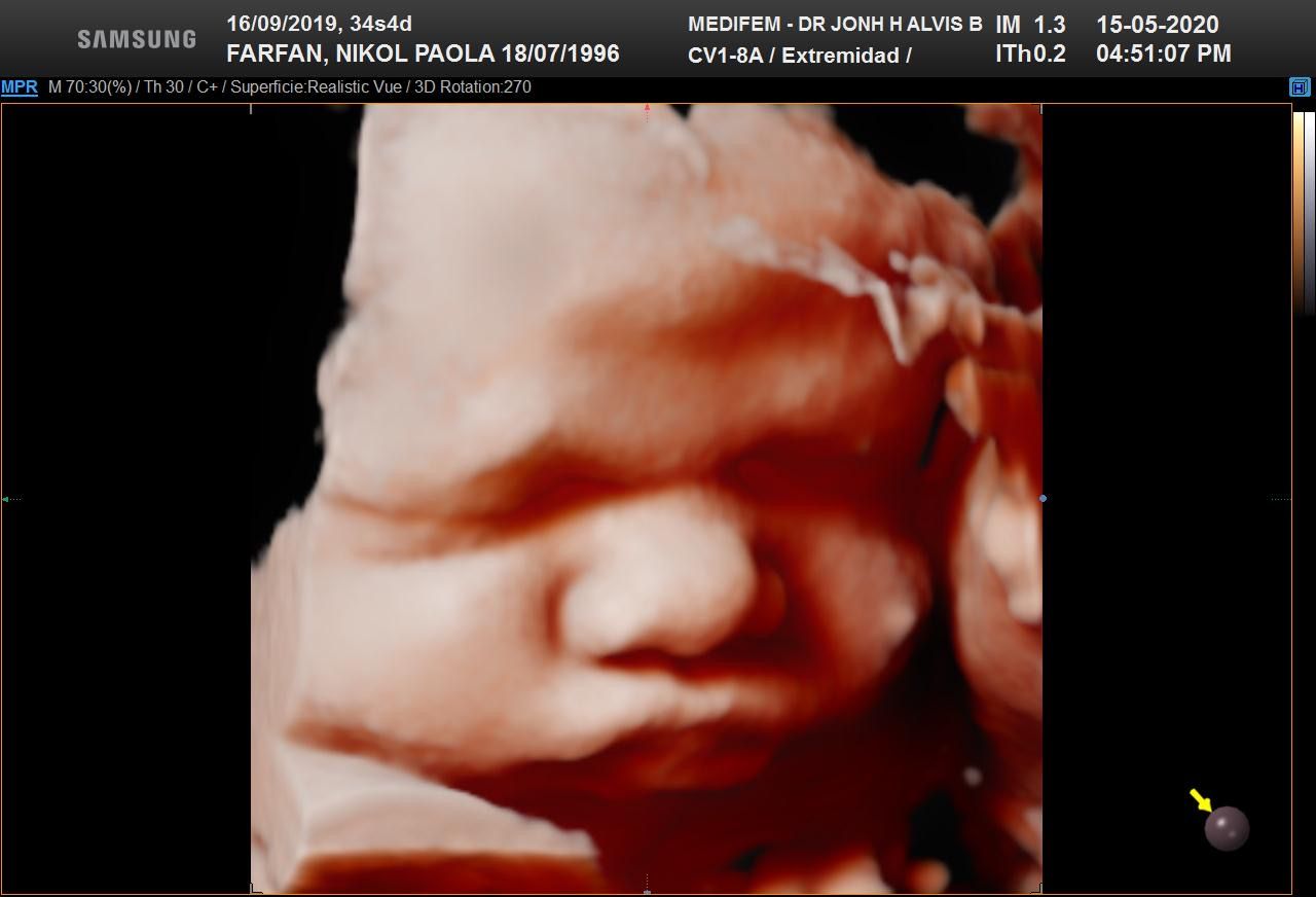 Jonh Harold Alvis Botello-16