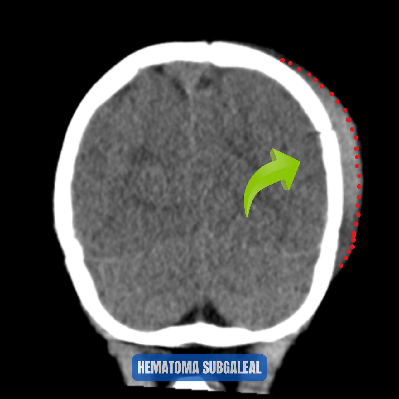 David Tafur Muñoz-2128