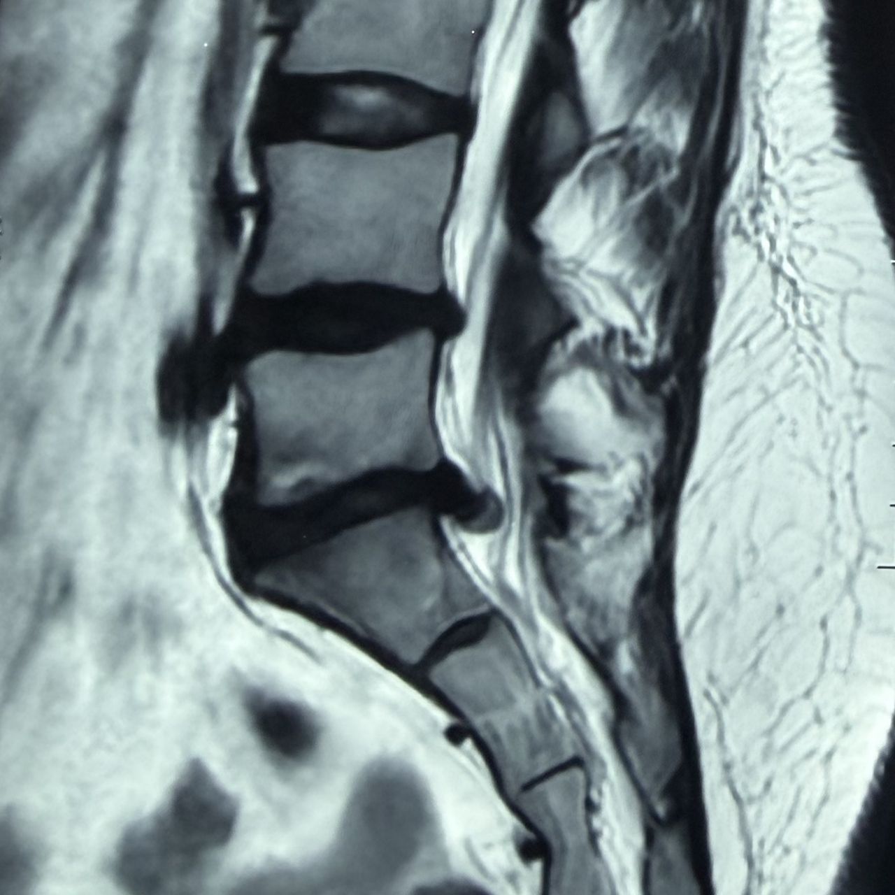 David Tafur Muñoz-2453