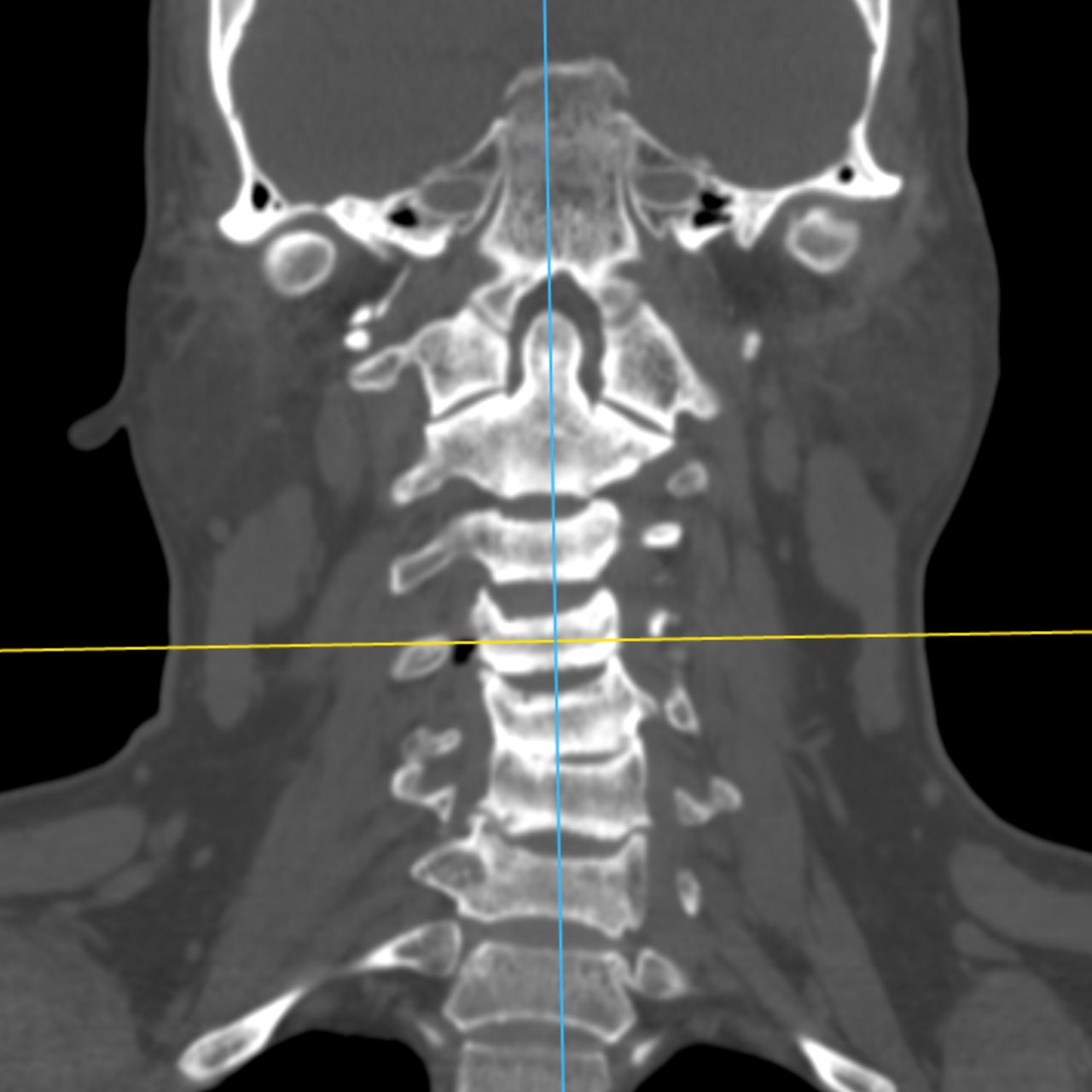 David Tafur Muñoz-1969