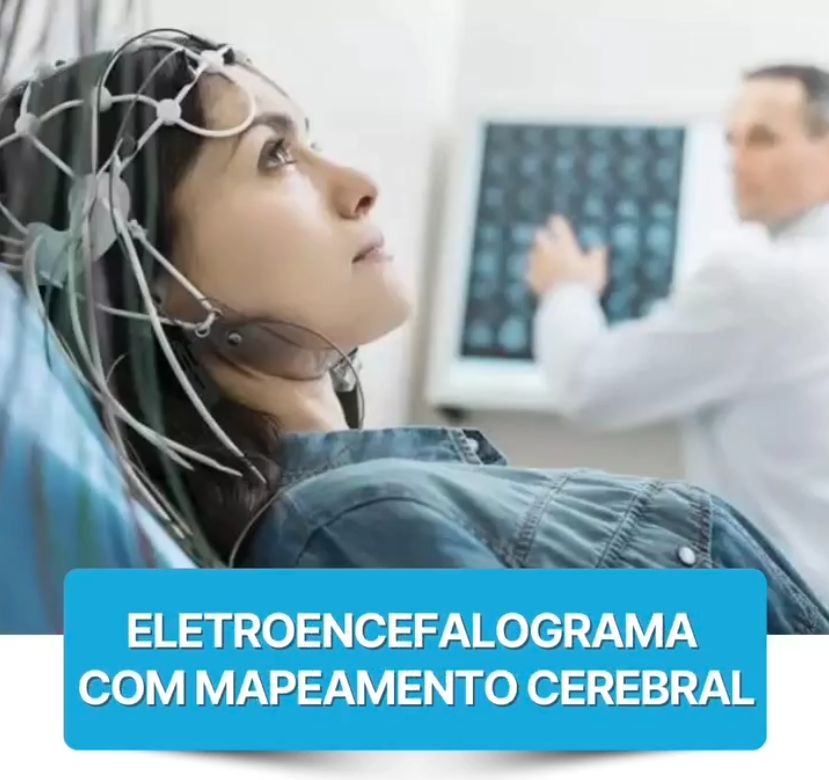 Exame Eletroencefalograma-0