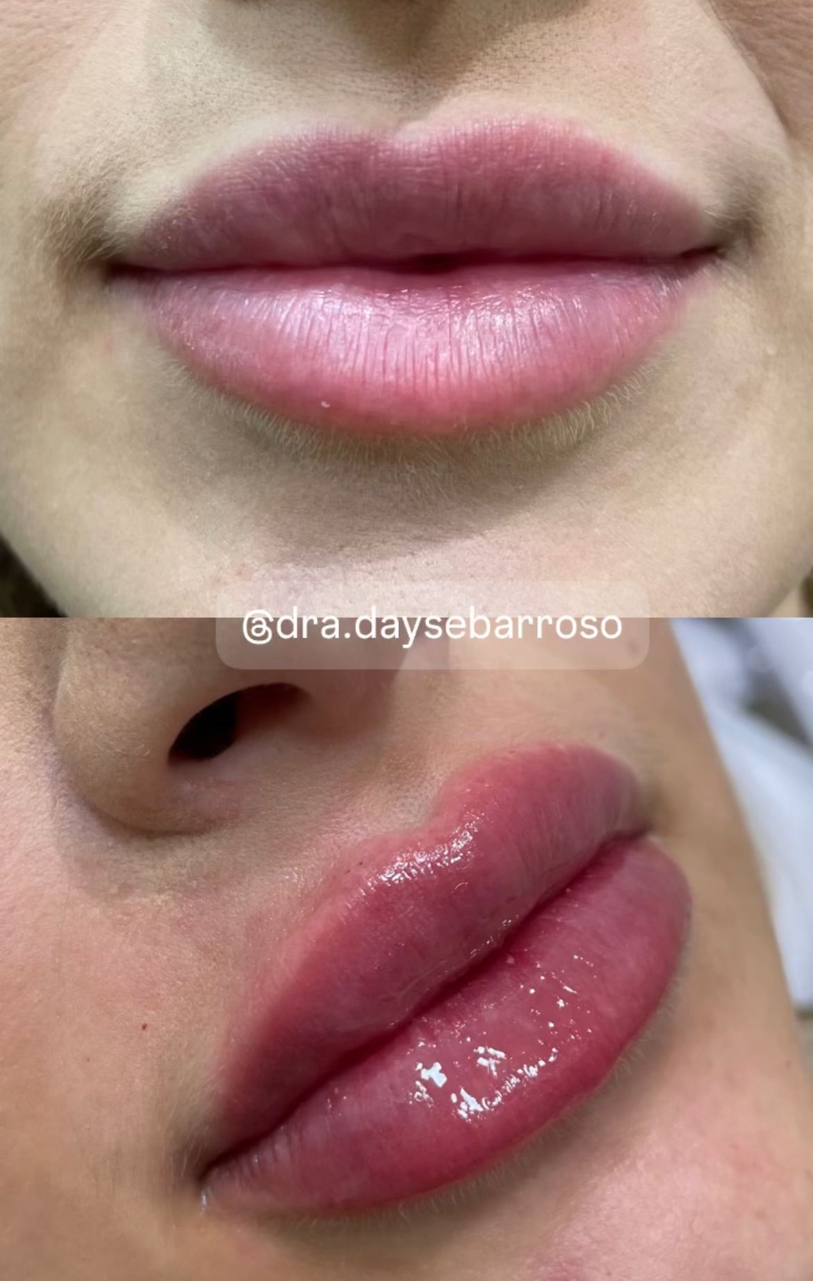 Dayse Hellen Teles Barroso-15