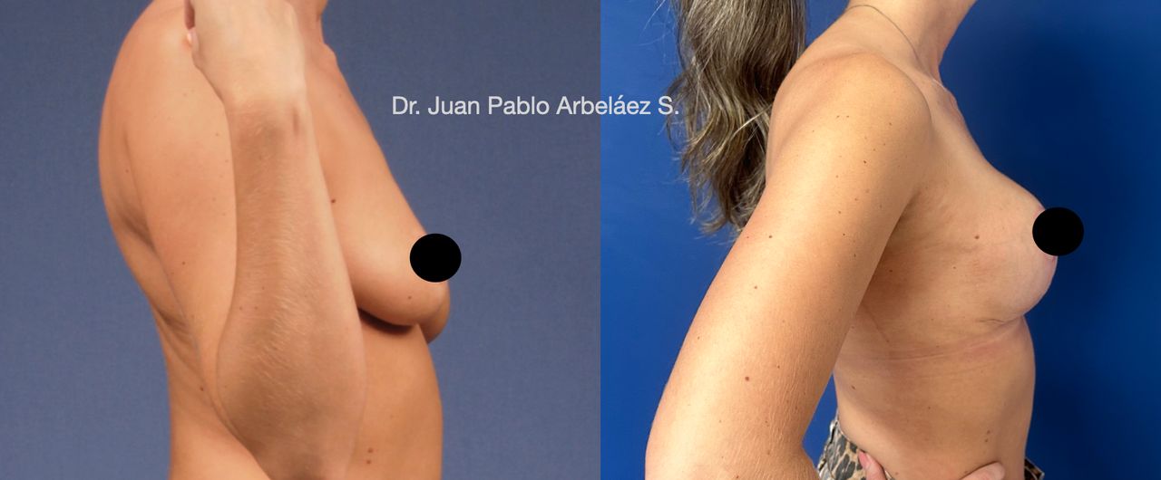 Juan Pablo Arbeláez Sierra-5