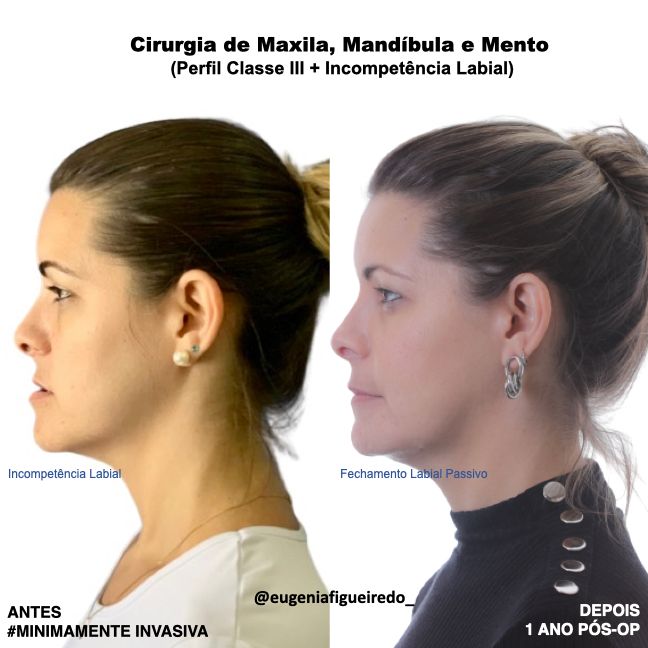 Eugênia Figueiredo-30