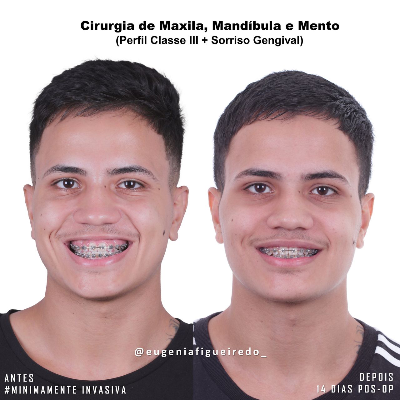 Eugênia Figueiredo-6