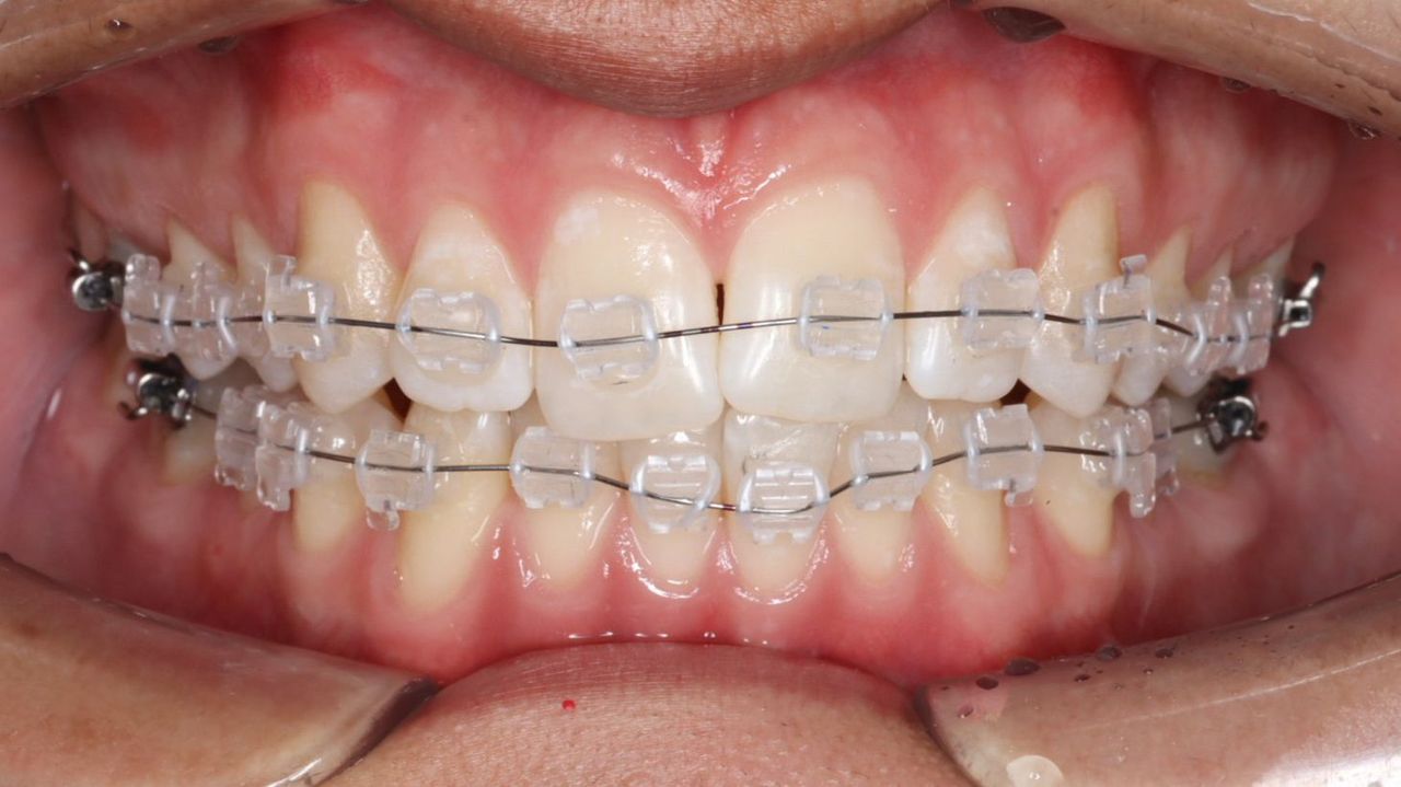 Rodrigo Hodar Dinamarca-8