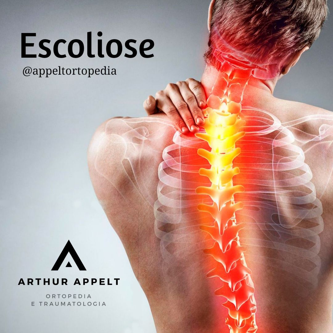 Arthur Lanna Appelt-2