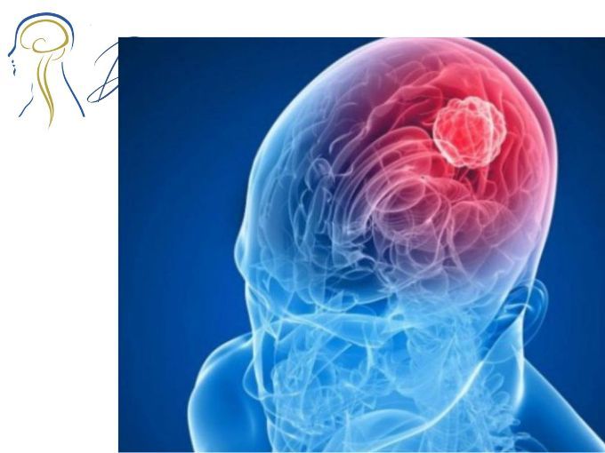 Denildo Veríssimo-20