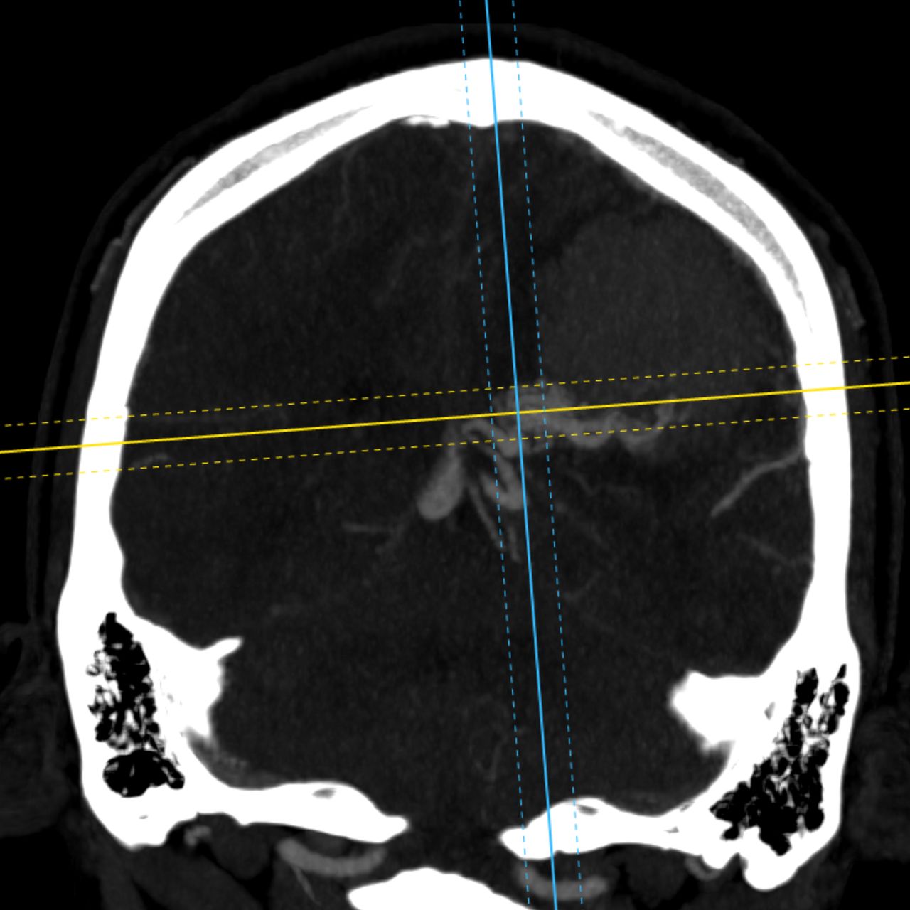 David Tafur Muñoz-1605