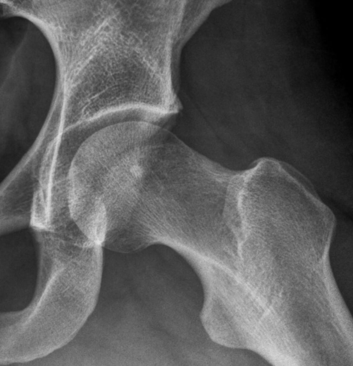 Marcus Vinicius Crestani-3