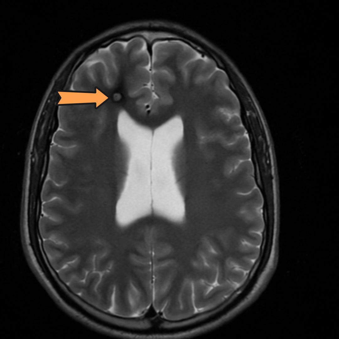 David Tafur Muñoz-2324